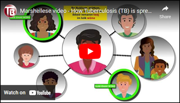 Marshallese video - How Tuberculosis (TB) is spread?